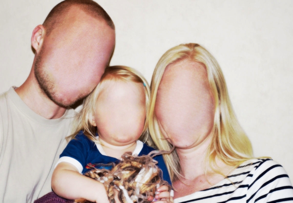 prosopagnosia